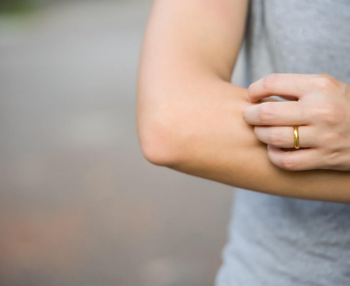 Plaques rouges sur la peau : les bons gestes en cas d-allergie