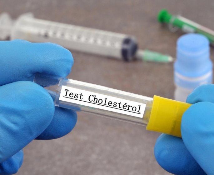 Suspicion de cholesterol : les examens a realiser