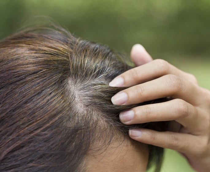 5 conseils pour eviter les cheveux gris