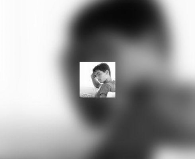 Risque de suicide des ados sous antidepresseurs