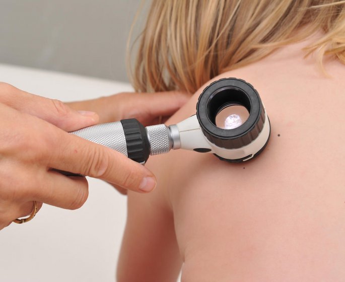 Taches rouges sur la peau : le purpura chez l-enfant