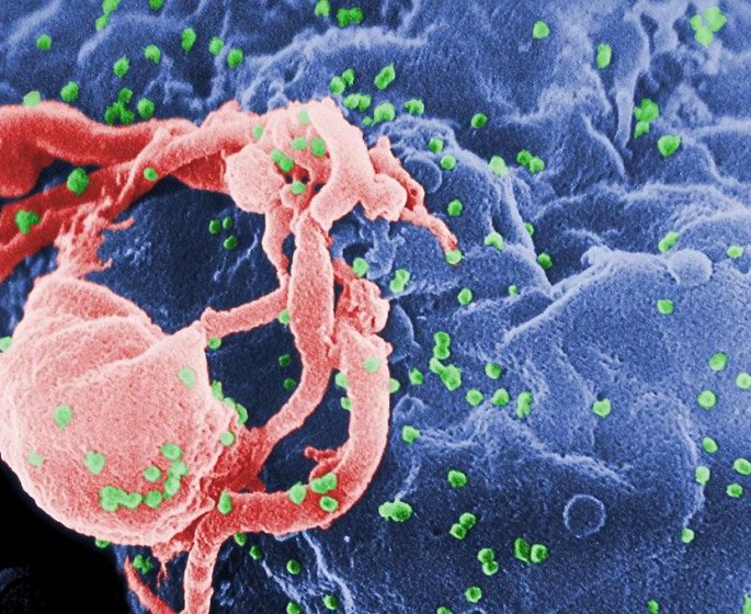 Infection par le VIH, Sida : les premiers signes