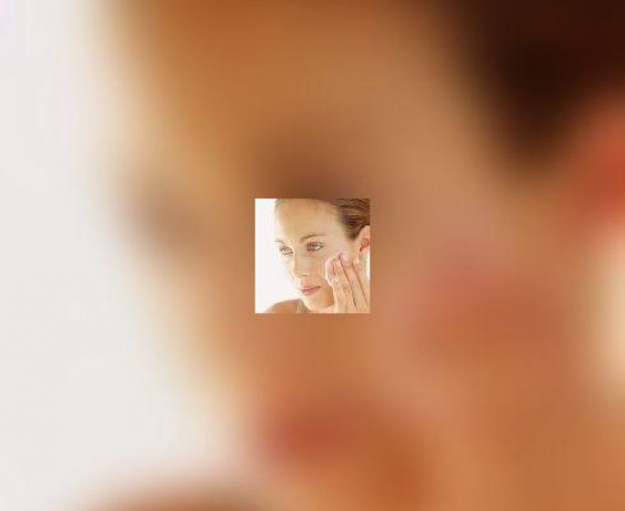 Un traitement contre l-acne sous haute surveillance