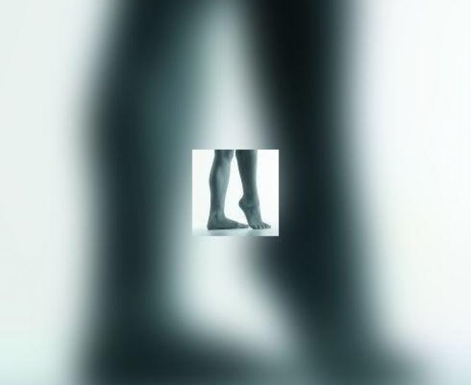 Hallux valgus, ou plus communement " oignon "