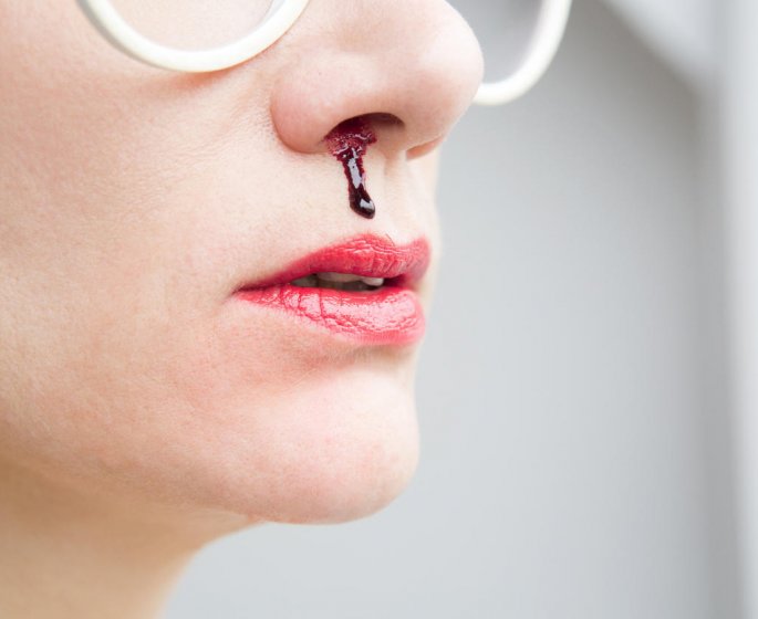 Saignement du nez et AVC hemorragique : un lien possible ?