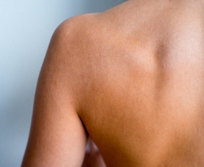 Quels sont les signes d’un zona ?