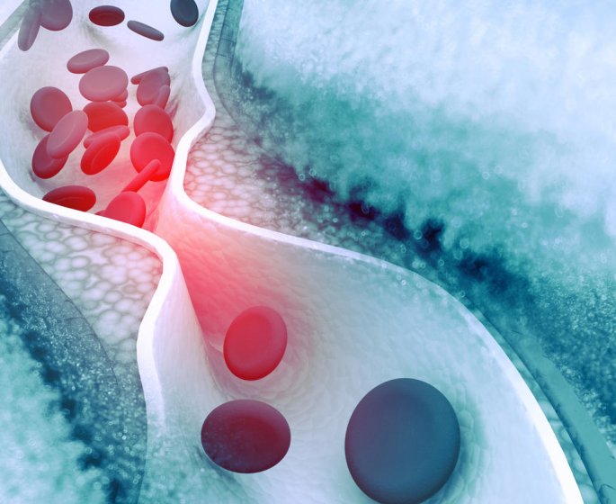 Cholesterol : les differents medicaments qui le reduisent