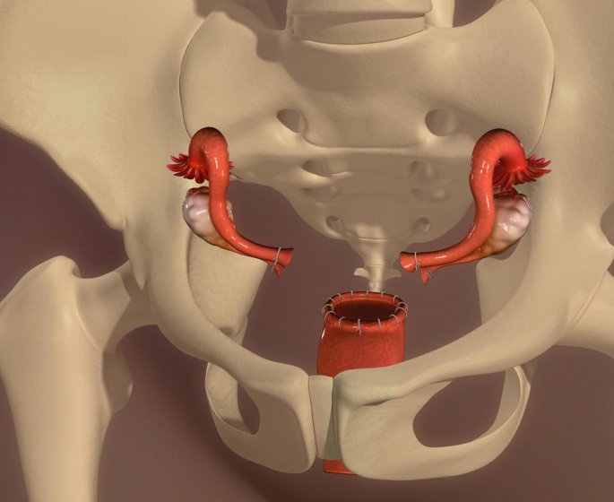 Hysterectomie : des consequences physiques et psychologiques...