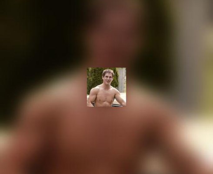 Epilation laser : les hommes aussi !