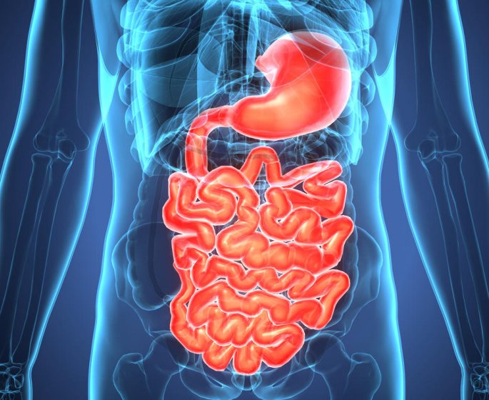 Diverticule de Meckel : tout savoir sur l-operation