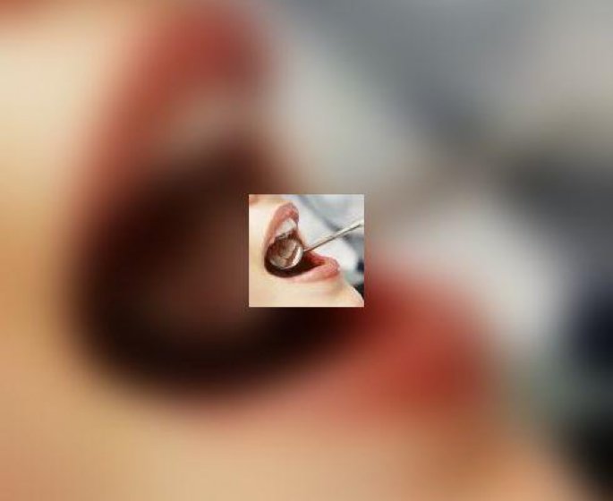 Caries dentaires et fluor : quid des nouvelles recommandations