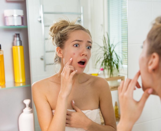 L’acne des adultes : quand l’acne joue les prolongations