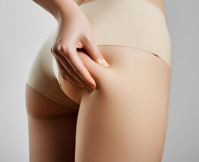 9 astuces pour ne plus avoir de culotte de cheval