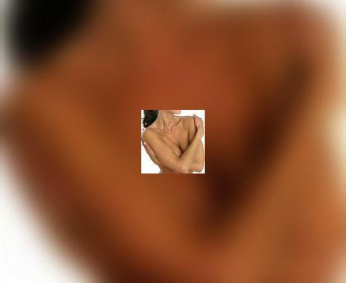 Reduction mammaire : aspects techniques et pratiques pour reduire la taille des seins