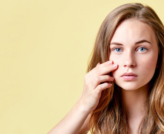 Acne : quelles solutions ?