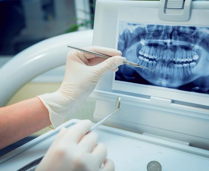 Les dents, victimes collaterales de certaines maladies