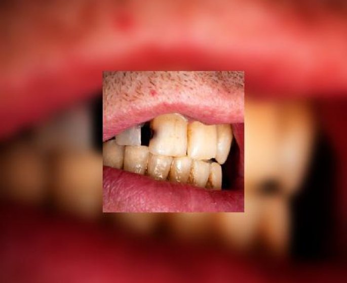 Des dents de vieux grace aux sodas ?