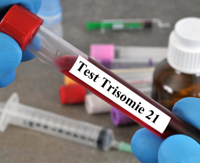 Trisomie 21 : un nouveau depistage propose a toutes les femmes enceintes