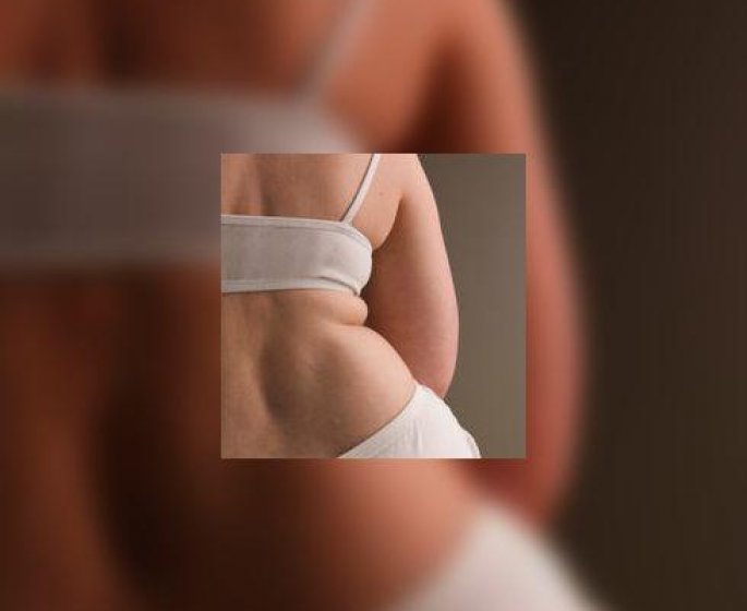 Faut-il perdre du poids avant une chirurgie de l’obesite ?