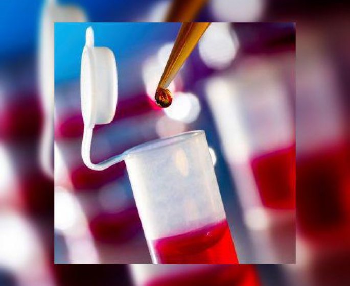 Ebola : l’urgence des traitements