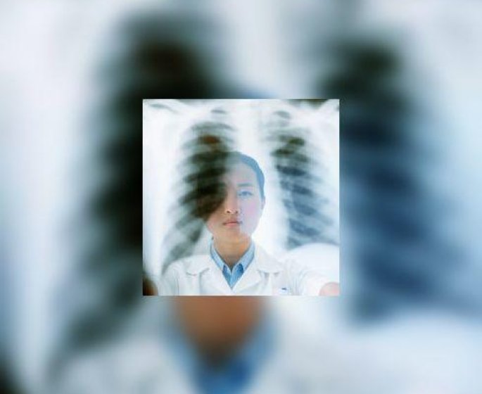Cancer du poumon : a quand le depistage annuel ?