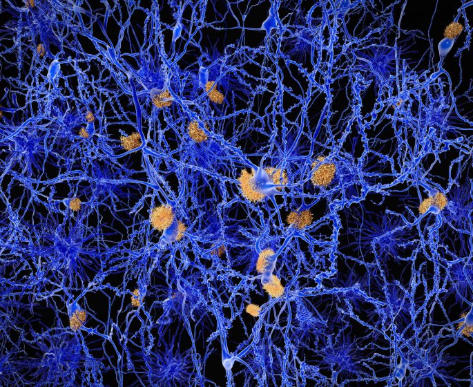 Des anticorps de lama pour detecter precocement la maladie d’Alzheimer