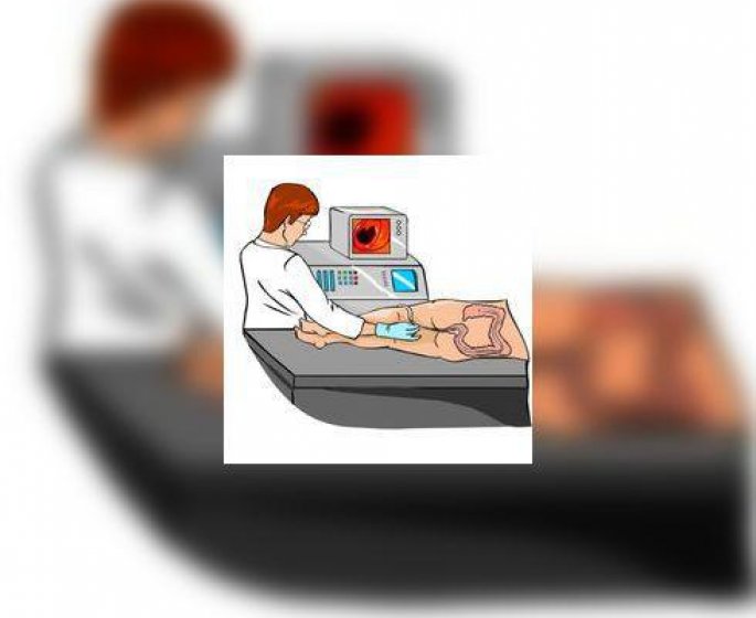 Coloscopie : un examen extremement courant