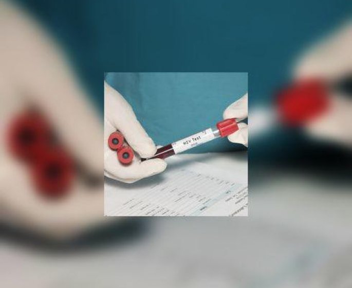 Le sida : premier cas de remission prolongee pour cette jeune Francaise de 18 ans