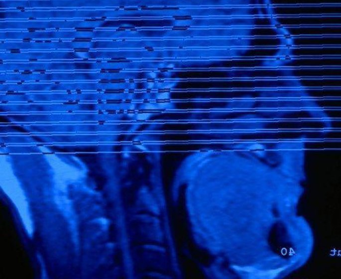 Arret du tabac : on peut lire vos chances de reussite dans votre cerveau