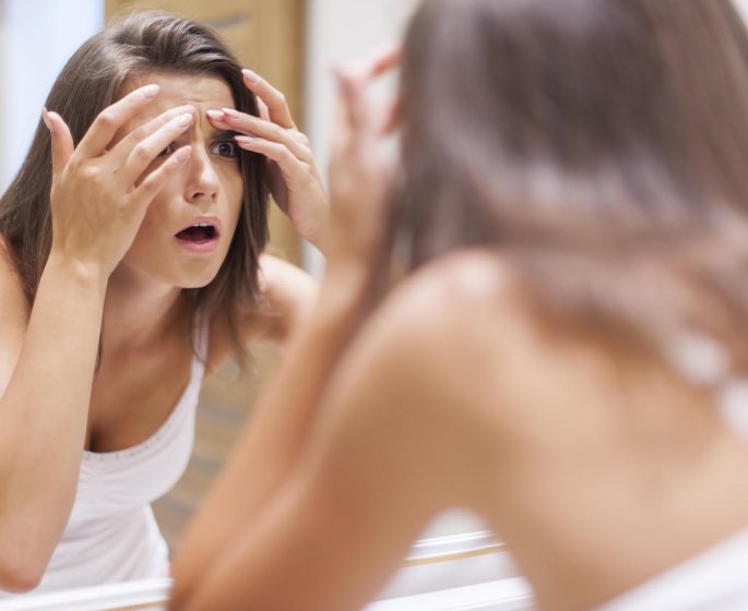 Acne : le probleme viendrait de la forme des follicules pileux