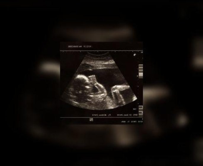 Dites non a l’echographie fœtale de plaisance !
