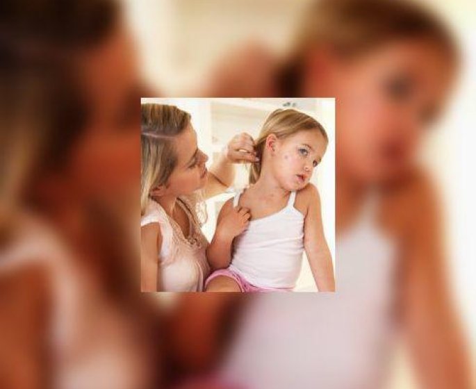 Epidemie de rougeole : deux doses de vaccin ROR s’imposent !
