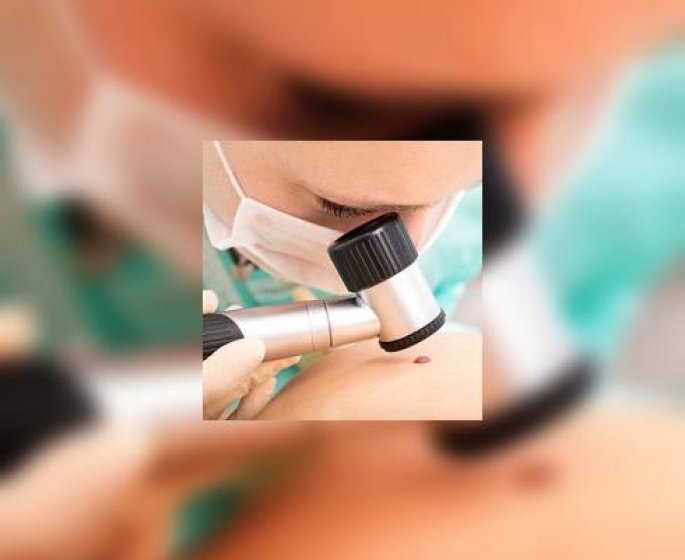 Montrez votre peau a un dermatologue !