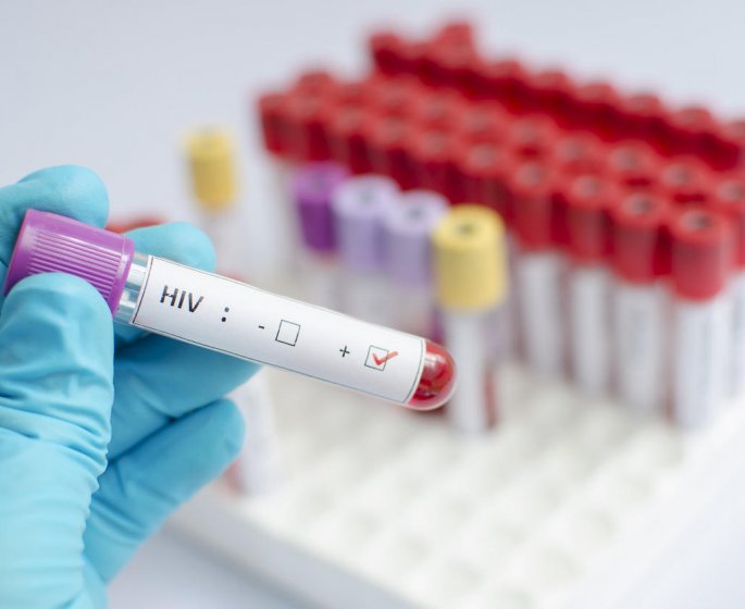 VIH : l’epidemie continue sa hausse en Europe