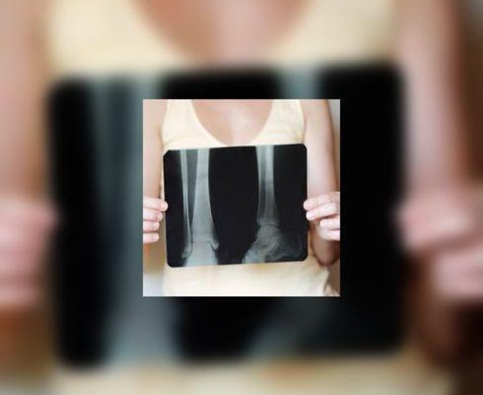 Le cancer augmente le risque d’osteoporose, y compris celui du col et de l-endometre…