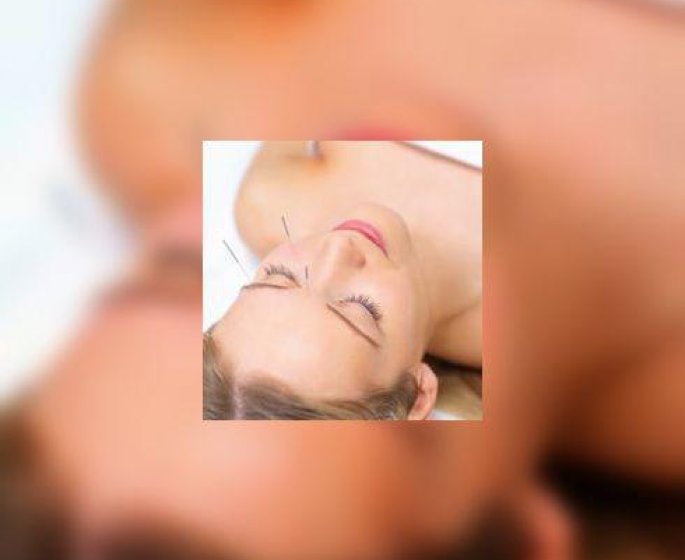 Acupuncture, preuve d’efficacite contre certaines douleurs : migraine, arthrose, lombalgie…
