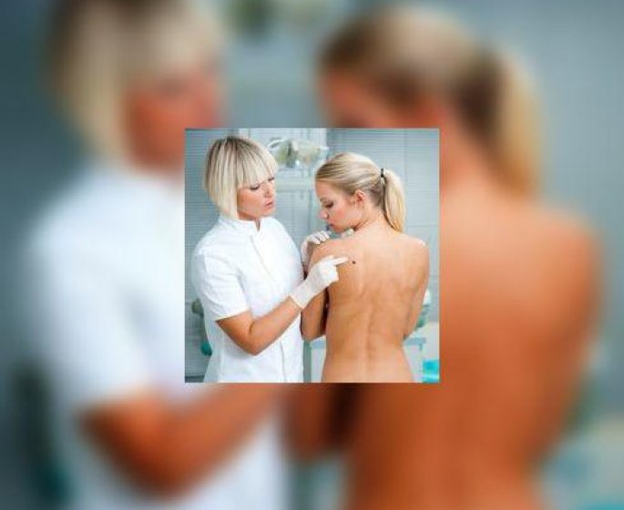 Melanome : simplification du depistage !