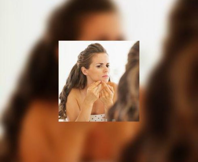 Pilule-acne : Diane 35, le retour