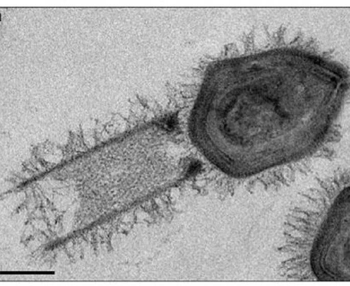 Deux virus geants ont ete decouverts au Bresil