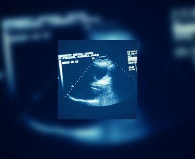 Les echographies par sonde contamineraient 30 000 personnes par an