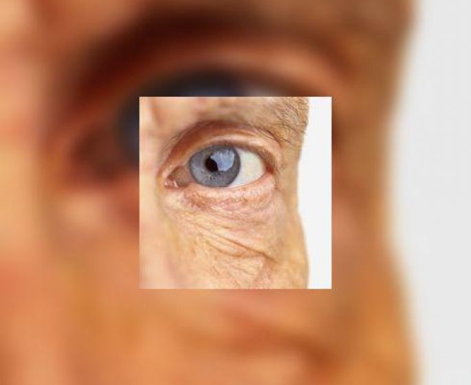 Parce que le glaucome est silencieux, il faut consulter un ophtalmologiste a partir de 45 ans