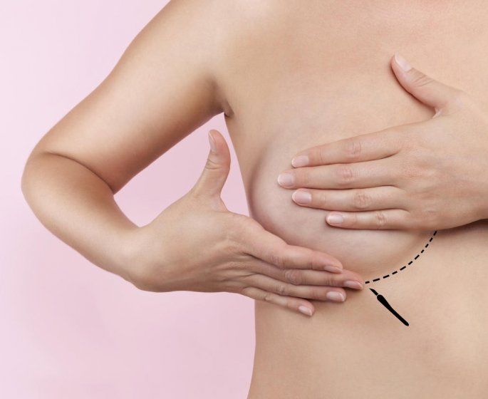 Chirurgie esthetique : 1 femme sur 2 privilegie l’operation des seins