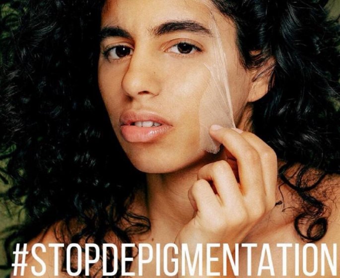 Cremes depigmentantes : pourquoi elles sont dangereuses pour la peau