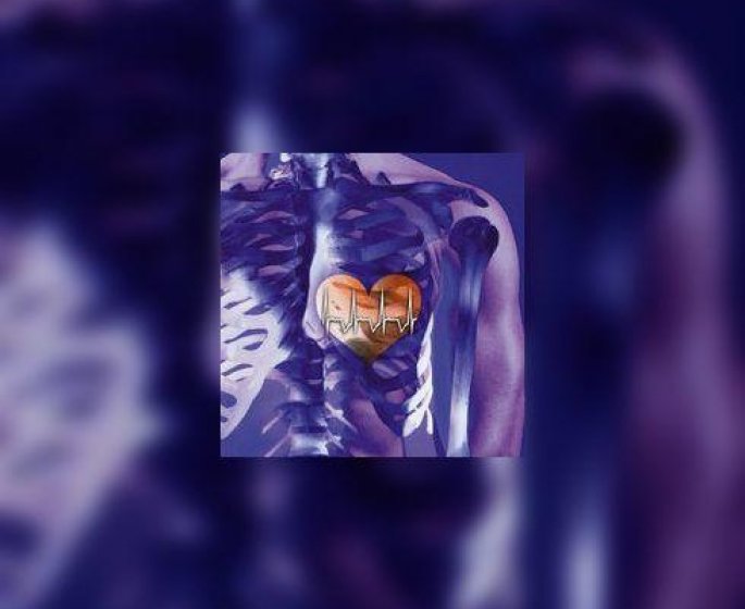 « Infarctus, une question de vie » : nouvelle campagne des cardiologues