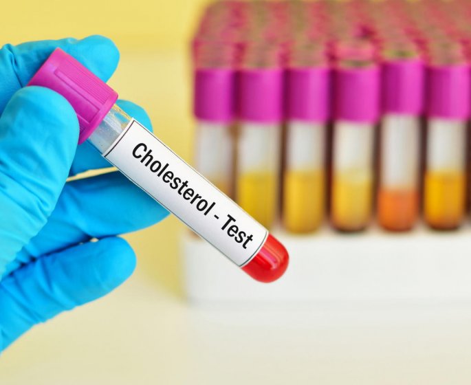 Hypercholesterolemie