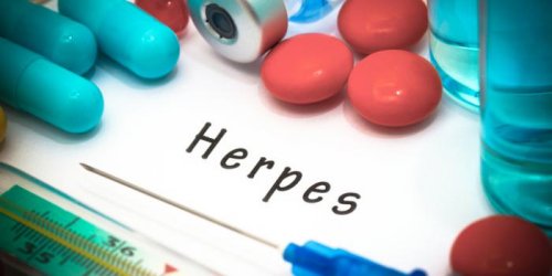 Herpes labial : agir des les premiers signes