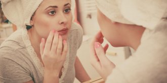 Acne : quand passer aux medicaments ?