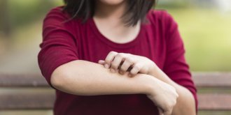 3 astuces pour soulager rapidement une urticaire