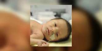 Rhesus negatif et grossesse : quelles consequences ?