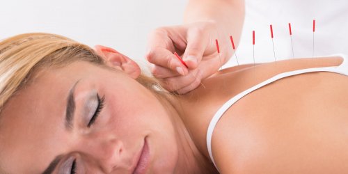 L-acupuncture, que soigne-t-elle au juste ? 